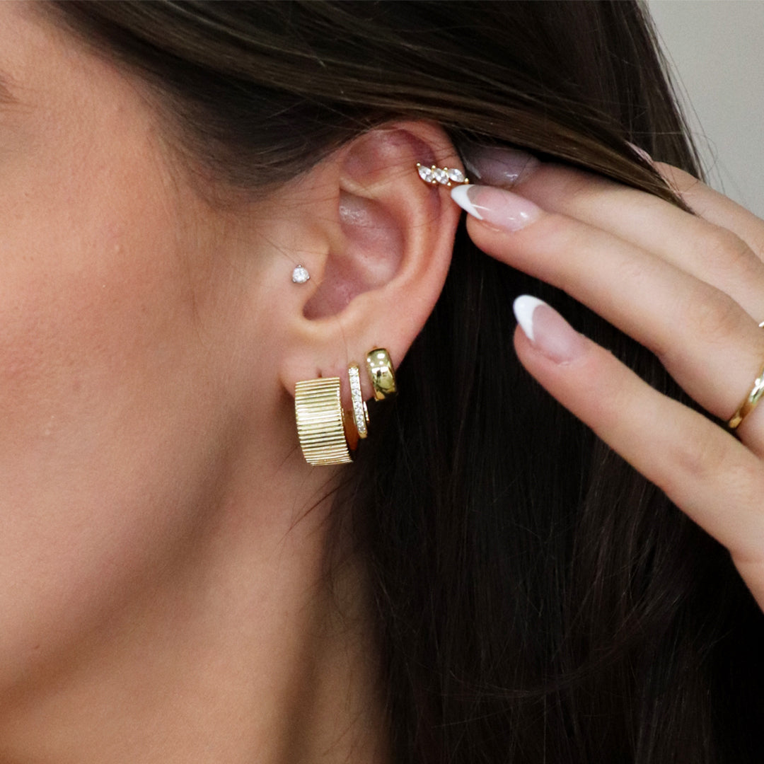 Aretes